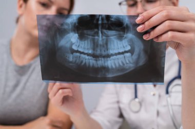 Resepsiyondaki bir kadın doktor ve bir hasta çene röntgenini tartışıyorlar.