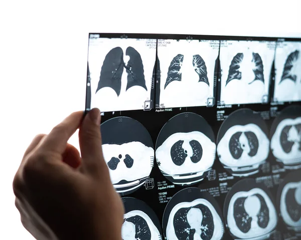 Uma Médica Examina Uma Ressonância Magnética Dos Órgãos Internos Abdómen — Fotografia de Stock
