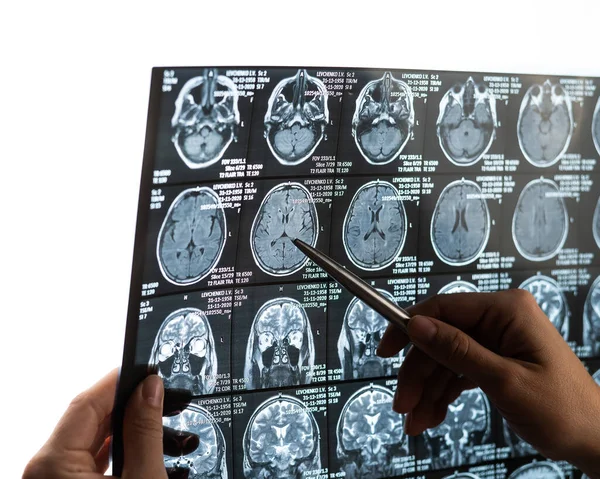 Uma Médica Examina Uma Ressonância Magnética Cérebro — Fotografia de Stock