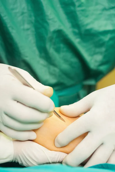 Крупный план хирурга, держащего скальпель — стоковое фото