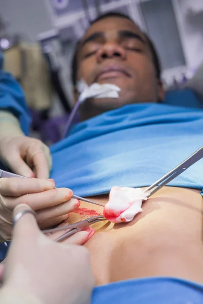 Close-up de um paciente a ser operado — Fotografia de Stock