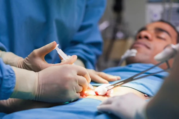 Close up of an operation — Stock Photo, Image