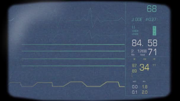 Tela completa do monitor cardíaco — Vídeo de Stock