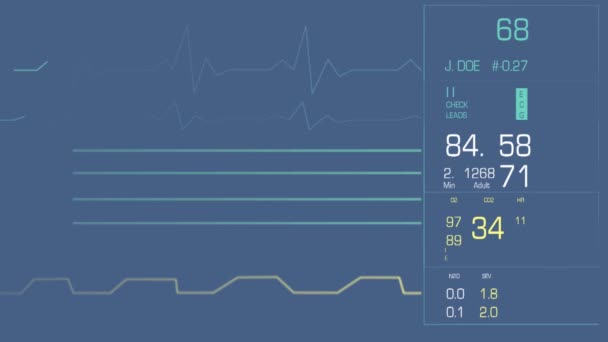 Monitor cardíaco limpio — Vídeo de stock