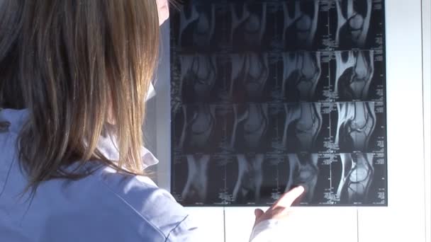 Filmagem de estoque de enfermeira com varredura de raios X — Vídeo de Stock