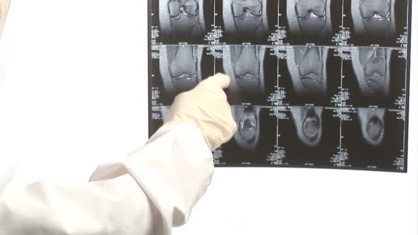 Behandeling van een xray — Stockvideo