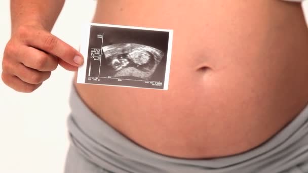 Pregnant woman holding a scan — Stock Video