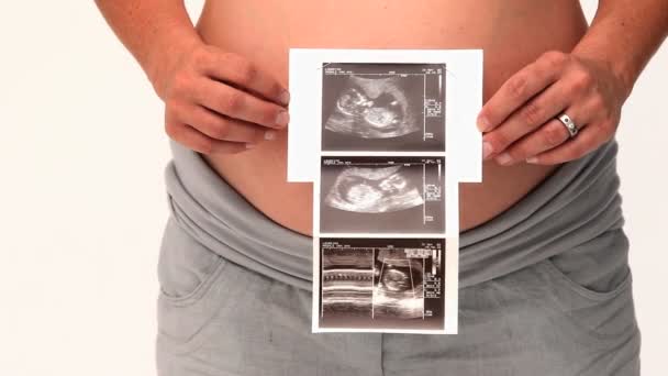 Pregnant woman holding a scan — Stock Video