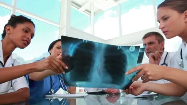 Медичний персонал, що працює над рентгенографією грудей — стокове відео