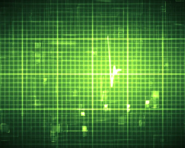 Yeşil EKG — Stok fotoğraf