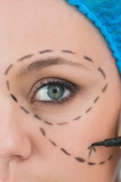 Surgeon writing on a woman's face — Stock Photo, Image