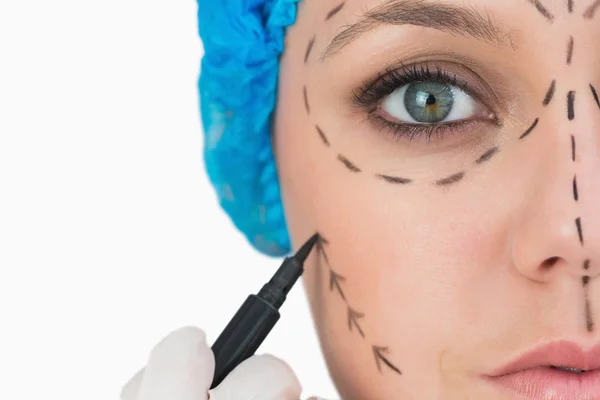 Plastic surgeon marking face — Stockfoto