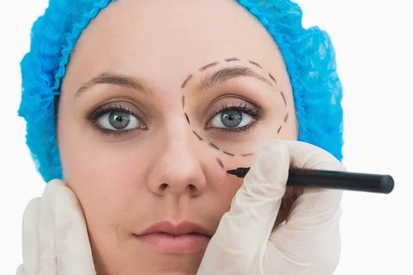 Plastic surgeon drawing around eye — Stock Photo, Image