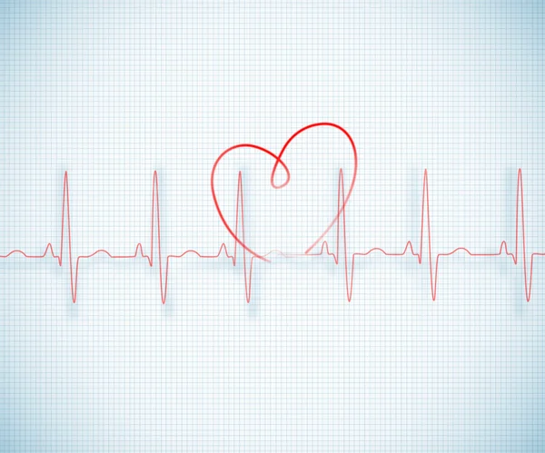 Red ECG line with heart graphic on grid background — Stock Photo, Image