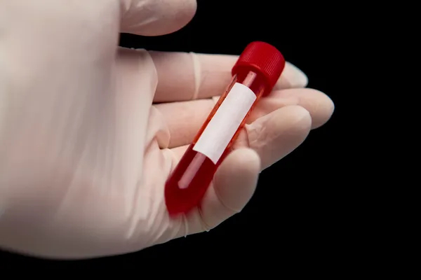Gehandschoende hand met Injectieflacon van bloed — Stockfoto