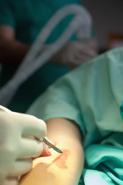 Médico que executa cirurgia em um braço — Fotografia de Stock