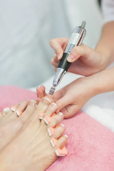 Hands removing callus at feet — Stock Photo, Image