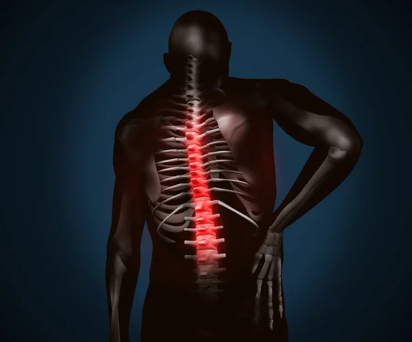 Black digital figure with back pain — Stock Photo, Image