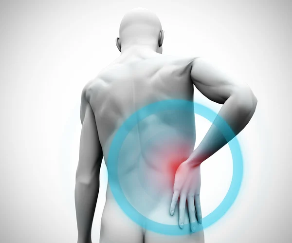 Digital model with back pain — Stock Photo, Image