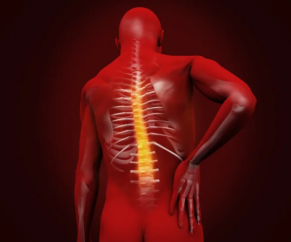 Red digital figure with highlighted back pain — Stock Photo, Image