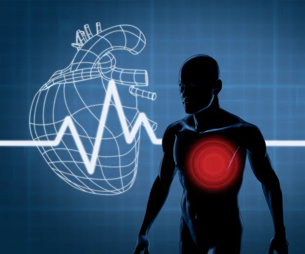 Mapping graphics heart and body — Stock Photo, Image