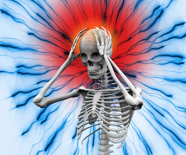 Ψηφιακή σκελετός έχοντας έναν πονοκέφαλο — Φωτογραφία Αρχείου
