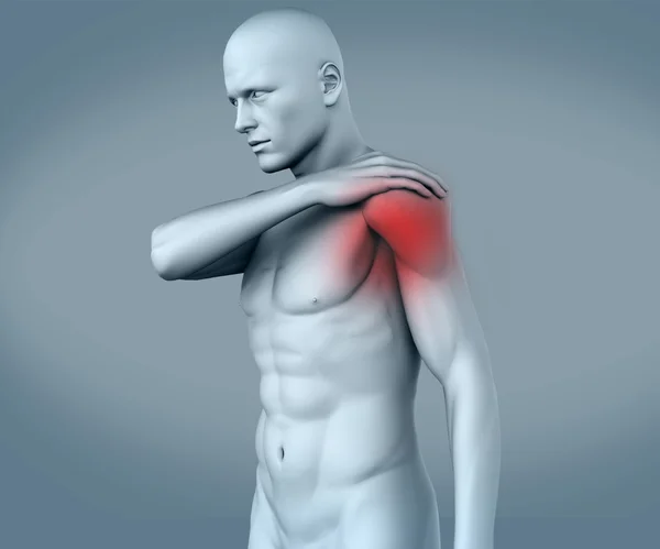 Shoulder pain — Stock Photo, Image