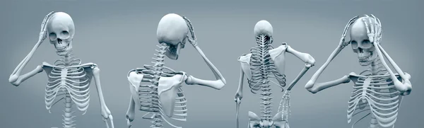 Skeletten met hoofdpijn — Stockfoto