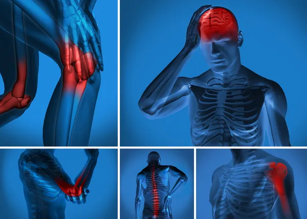Smärta i olika kroppen — Stockfoto