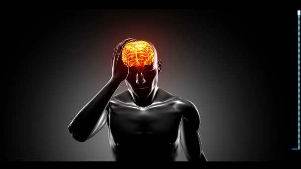 Lidská postava se bolest hlavy s klipy z různých důvodů uvedených — Stock video