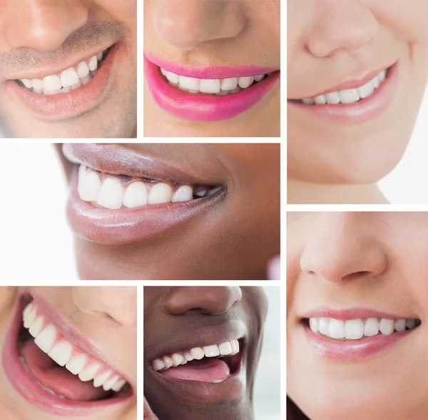 Collage de sourires blancs — Photo