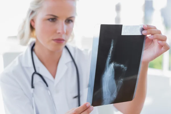 Serious nurse holding an x-ray — Stock Photo, Image