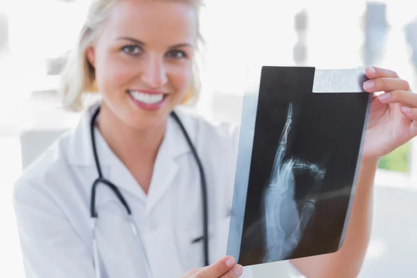 Cheerful nurse holding an x-ray — Stock Photo, Image