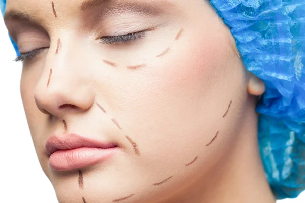 Gros plan sur un magnifique jeune patient avec des lignes pointillées sur le visage — Photo