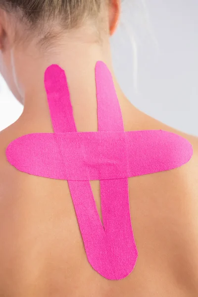 Female patients back with applied kinesio tape — Stock Photo, Image