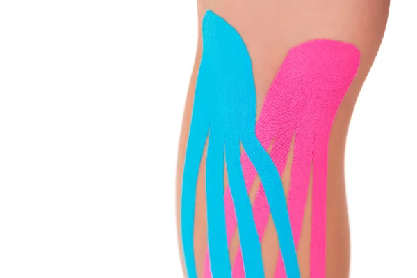 Close up van patiënten knie met toegepaste roze en blauwe kinesio tape — Stockfoto