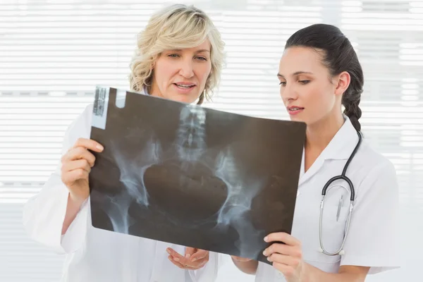 Deux médecins féminines sérieuses examinant la radiographie — Photo