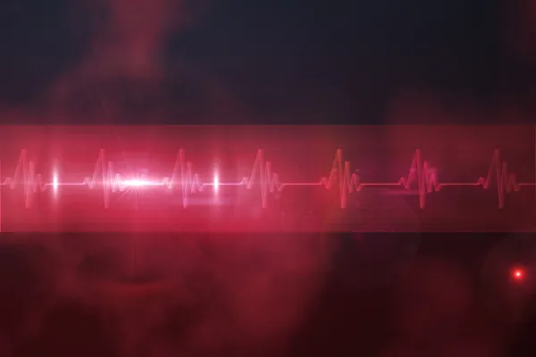 EKG hat kırmızı ve siyah — Stok fotoğraf