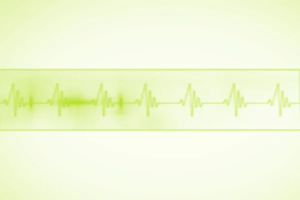 緑の心電図ラインと医療の背景 — ストック写真