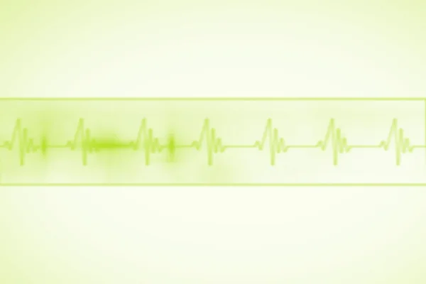 Fondo medico con linea verde ecg — Foto Stock