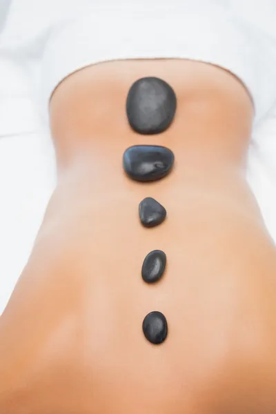 Beautiful woman receiving stone massage at spa center — Stock Photo, Image