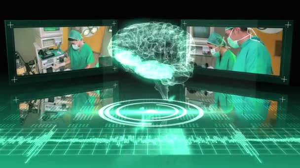 Gráfico cerebral giratório com clipes de cirurgia — Vídeo de Stock