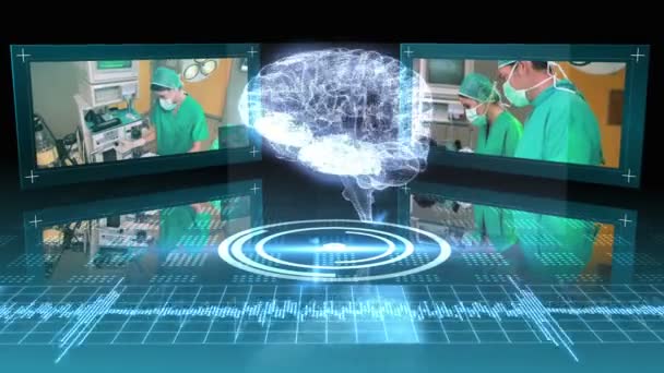 Вращающаяся графика мозга с хирургическими клипами — стоковое видео