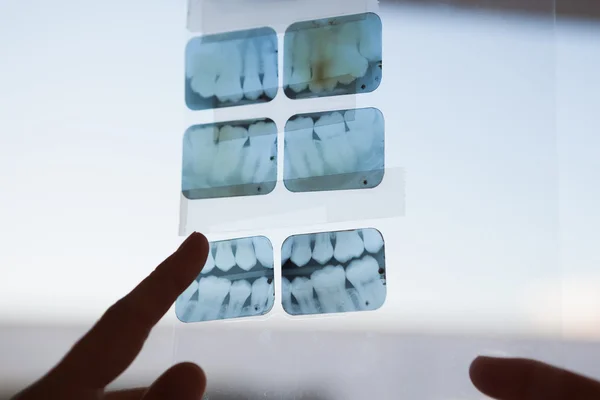 Стоматологи дивляться і вказують на рентген — стокове фото