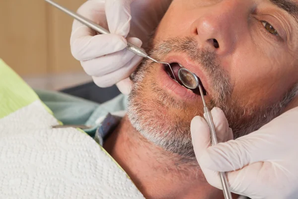 Dentista examinando los dientes de un paciente — Foto de Stock