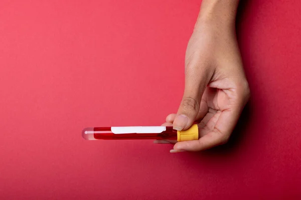 Cropped Hand Woman Holding Test Tube Blood Red Background Copy — стоковое фото