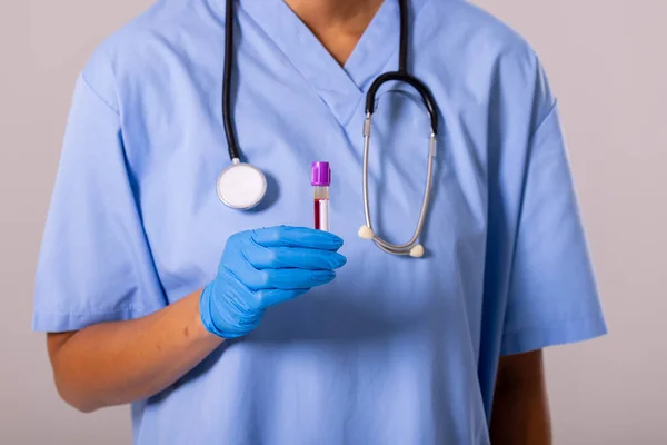 Midsection Female Doctor Wearing Glove Holding Test Tube Blood Stethoscope — Stockfoto