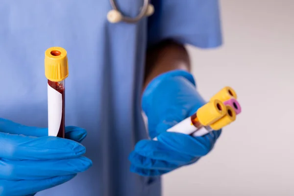 Midsection Female Doctor Wearing Gloves Holding Test Tubes Blood Medical — Foto de Stock