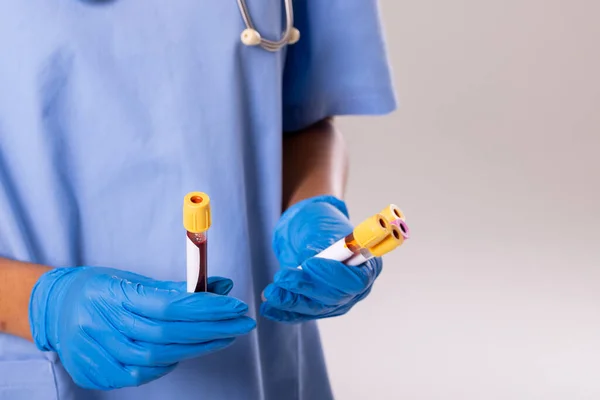 Midsection Female Doctor Wearing Gloves Holding Test Tubes Copy Space — Photo
