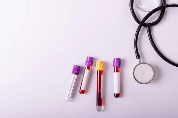 Directly Shot Stethoscope Test Tubes Blood Samples White Background Copy — Fotografia de Stock